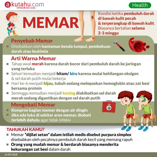 Memar
