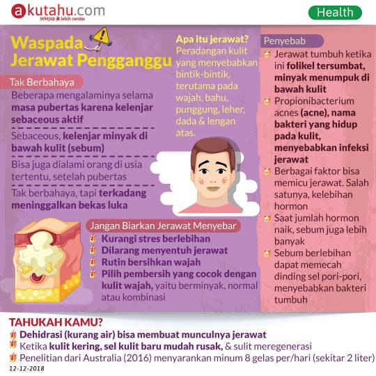 Waspada Jerawat Pengganggu