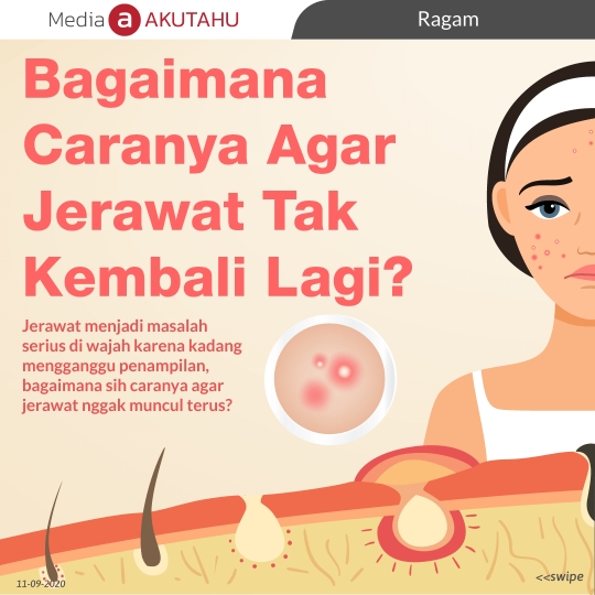 Bagaimana Caranya Agar Jerawat Tak Kembali Lagi?