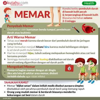 Memar