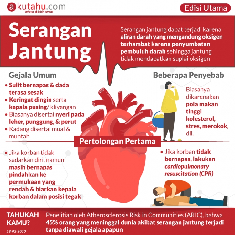 Serangan Jantung