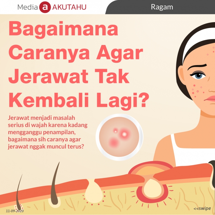 Bagaimana Caranya Agar Jerawat Tak Kembali Lagi?