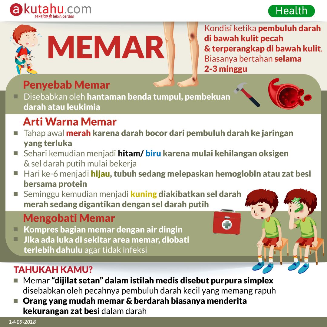 Memar