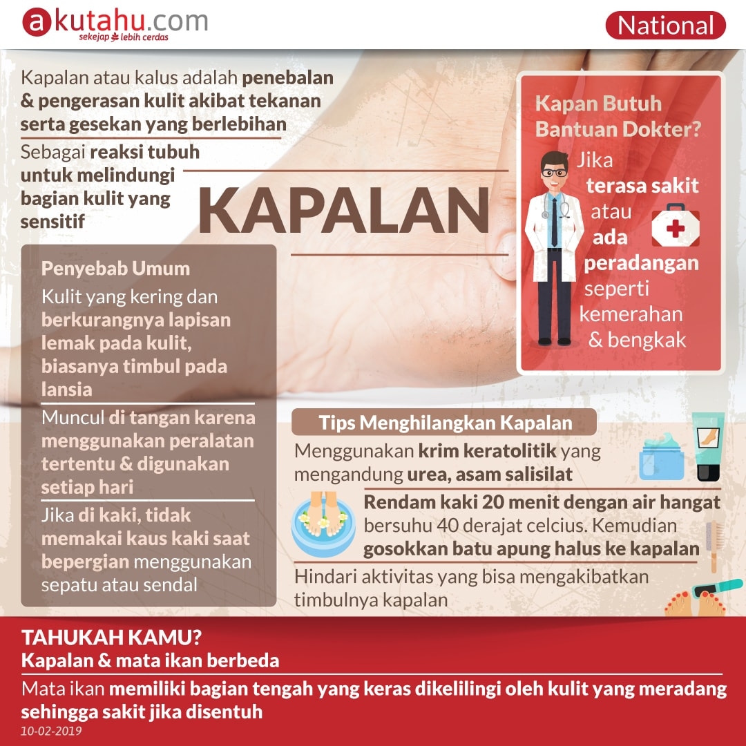 Kapalan