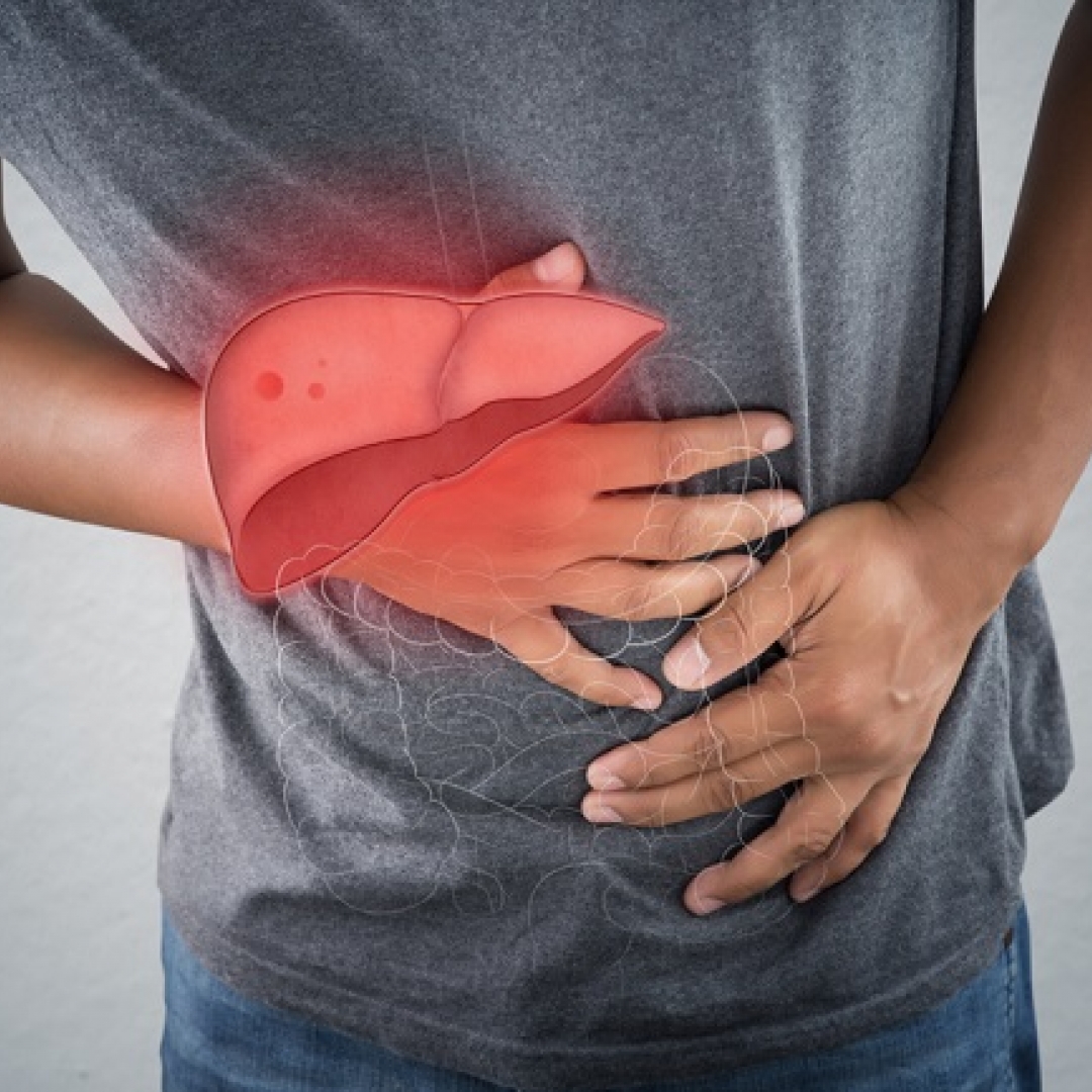 Wabah Hepatitis Akut Misterius