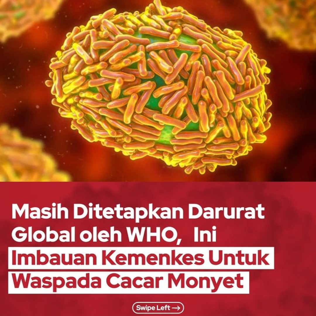Masih Ditetapkan Darurat Global oleh WHO, Ini Imbauan Kemenkes Untuk Waspada Cacar Monye